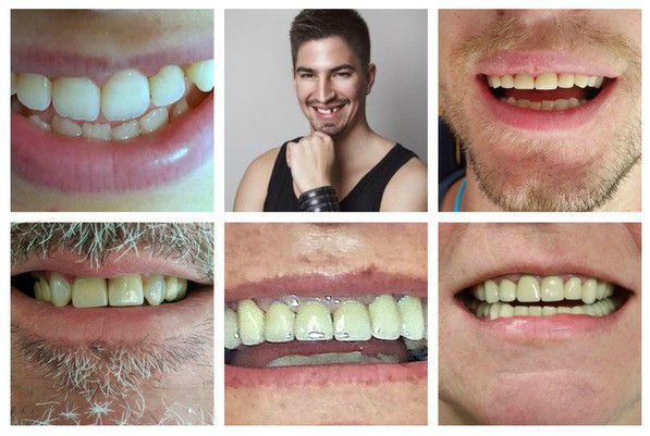 dentist abroad photos, irish dental work